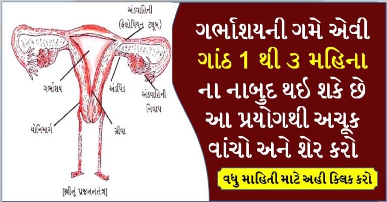 ગર્ભાશયની ગમે એવી ગાંઠ 1 થી ૩ મહિનામાં નાબુદ થઇ શકે છે આ પ્રયોગથી અચૂક વાંચો અને શેર કરો