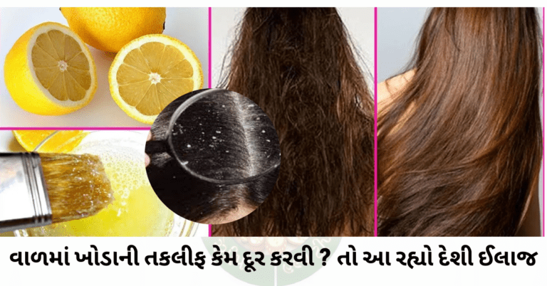 વાળમાં ખોડાની તકલીફ કેમ દૂર કરવી ? તો આ રહ્યો દેશી ઈલાજ