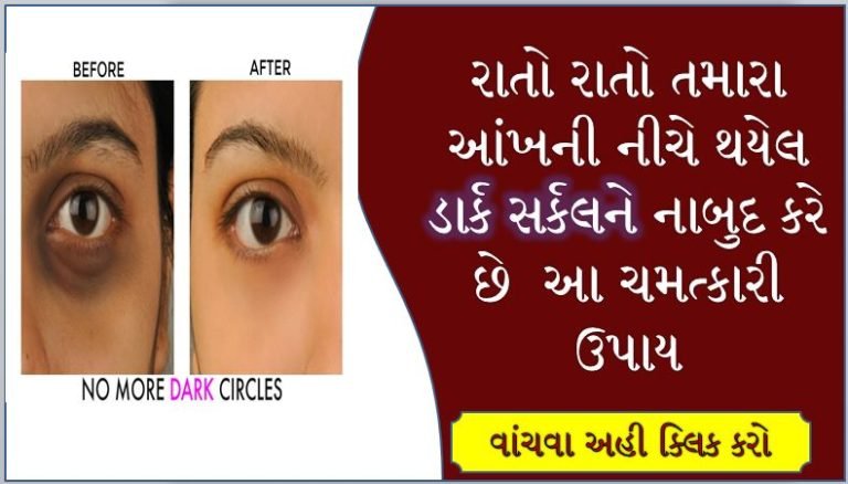 આંખના ગમે એવા ડાર્ક સર્કલ દૂર કરવા માટે અપનાવો આ ઉપાય