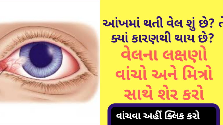 આંખમાં થતી વેલ શું છે? તે ક્યાં કારણથી થાય છે? વેલના લક્ષણો વાંચો અને મિત્રો સાથે શેર કરો