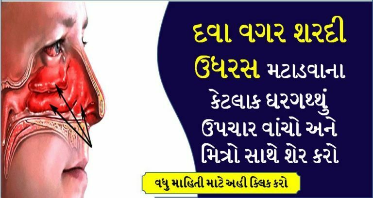 દવા વગર શરદી મટાડવાના કેટલાક ઘરગથ્થું ઉપચાર વાંચો અને મિત્રો સાથે શેર કરો