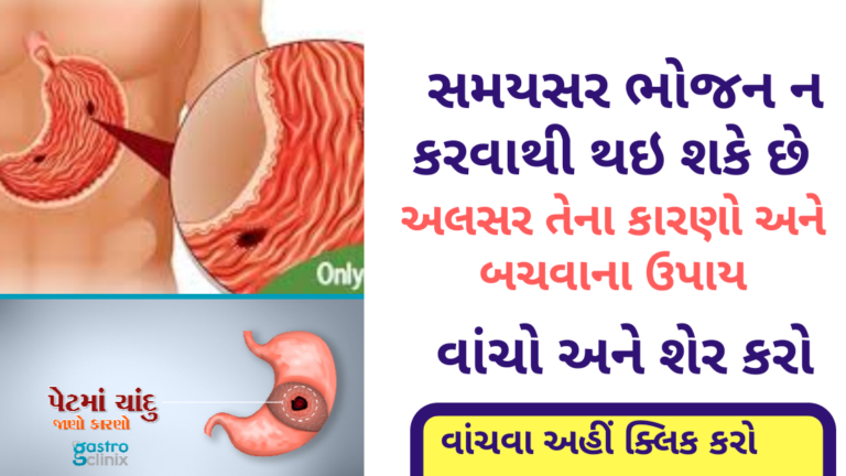 સમયસર ભોજન ન કરવાથી થઇ શકે છે અલસર તેના કારણો અને બનવાના ઉપાય વાંચો અને શેર કરો