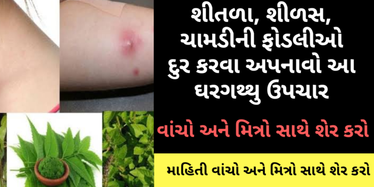 શીતળા, શીળસ, ચામડીની ફોડલીઓ દુર કરવા અપનાવો આ ઘરગથ્થુ ઉપચાર