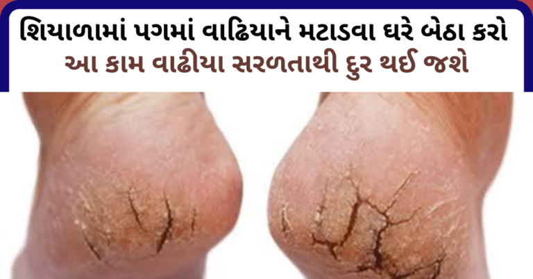 શિયાળામાં પગમાં વાઢિયાને મટાડવા ઘરે બેઠા કરો આ કામ વાઢીયા સરળતાથી દુર થઈ જશે