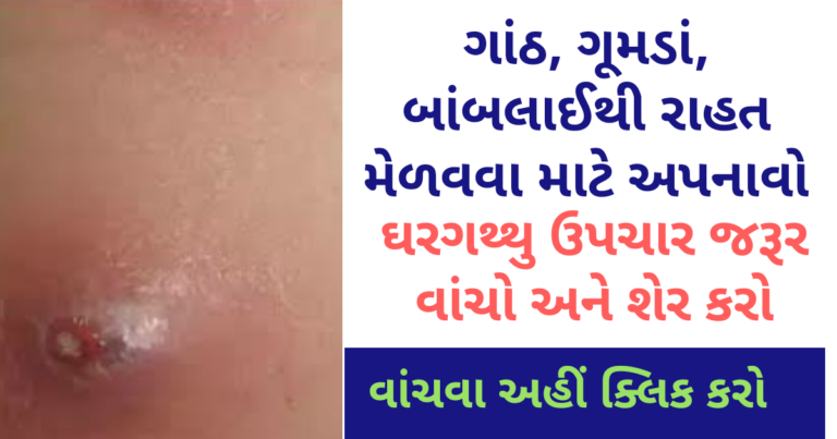 ગાંઠ ગૂમડાં બાંબલાઈથી રાહત મેળવવા માટે અપનાવો આ ઘરગથ્થુ ઉપચાર જરૂર વાંચો અને શેર કરો