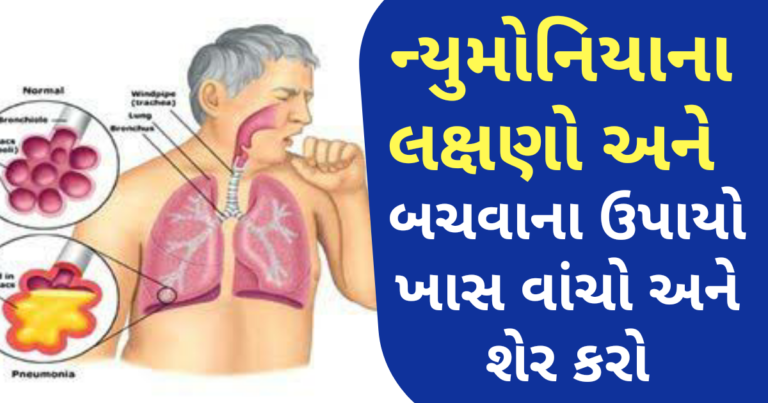 ન્યુમોનિયાના લક્ષણો અને બચવાના ઉપાયો ખાસ વાંચો અને શેર કરો
