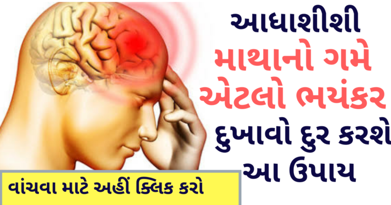 આધાશીશી માથાનો ગમે એટલો ભયંકર દુખાવો દુર કરશે આ ઉપાય