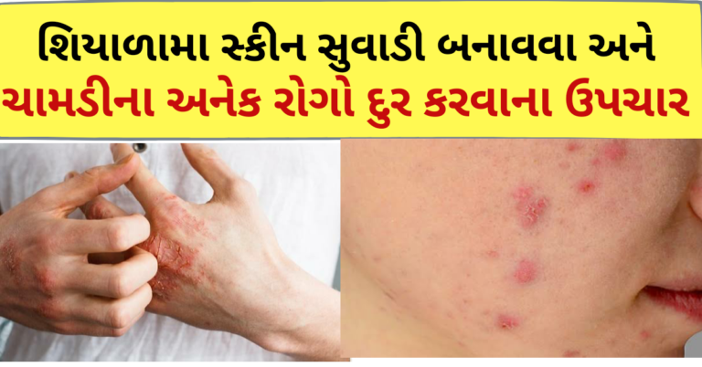 શિયાળામા સ્કીન સુવાડી બનાવવા અને ચામડીના અનેક રોગો દુર કરવાના ઉપચાર