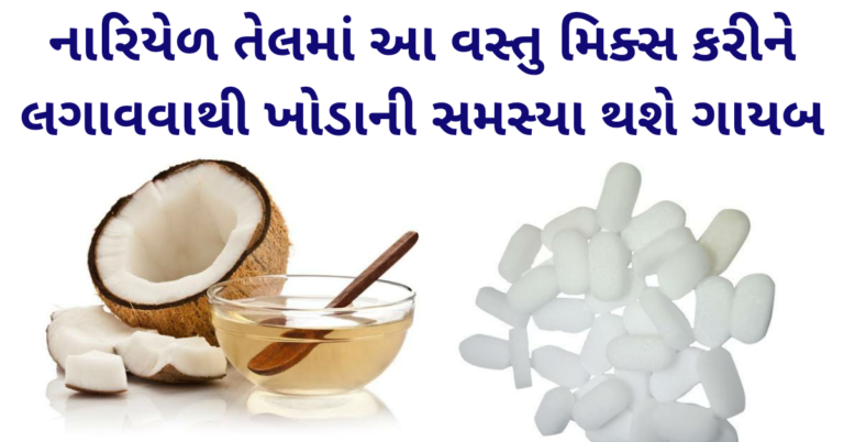 નારિયેળ તેલમાં આ વસ્તુ મિક્સ કરીને લગાવવાથી ખોડાની સમસ્યા થશે ગાયબ