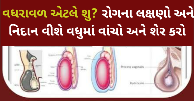 વધરાવળ એટલે શુ? રોગના લક્ષણો અને નિદાન વીશે વધુમાં વાંચો અને શેર કરો