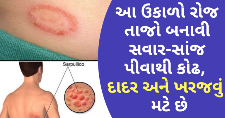 આ ઉકાળો રોજ તાજો બનાવી સવાર-સાંજ પીવાથી કોઢ, દાદર અને ખરજવું મટે છે