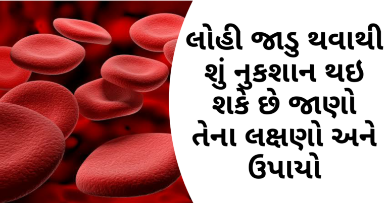 લોહી જાડુ થવાથી શું નુકશાન થઇ શકે છે જાણો તેના લક્ષણો અને ઉપાયો
