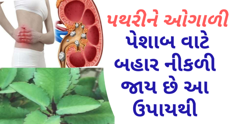 પથરીને ઓગાળી પેશાબ વાટે બહાર નીકળી જાય છે આ ઉપાયથી