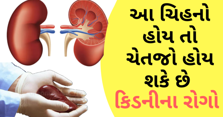 આ ચિહનો હોય તો ચેતજો હોય શકે છે કિડનીના રોગો