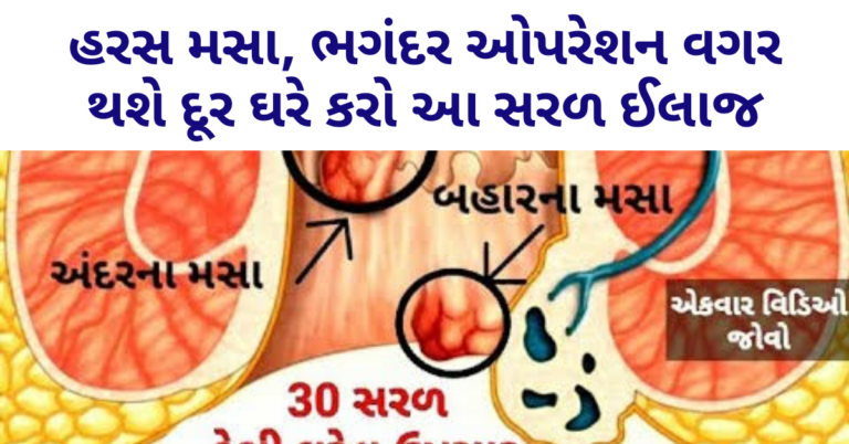 હરસ મસા, ભગંદર ઓપરેશન વગર થશે દૂર ઘરે કરો આ સરળ ઈલાજ