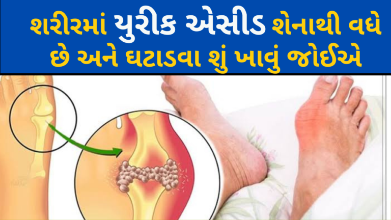 શરીરમાં યુરીક અેસીડ શેનાથી વધે છે અને ઘટાડવા શું ખાવું જોઈએ વાંચવા અહીં ક્લિક કરો