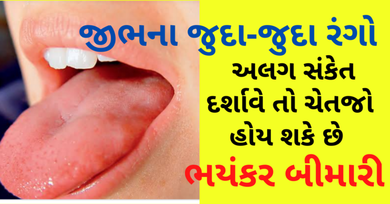 જીભના જુદા-જુદા રંગો અલગ સંકેત દર્શાવે તો ચેતજો હોય શકે છે ભયંકર બીમારી