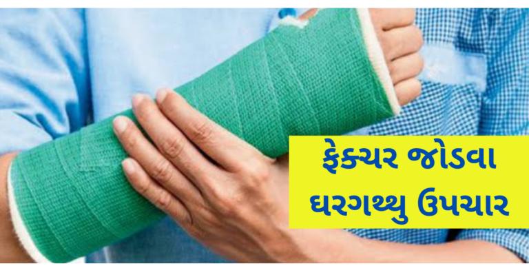 ફેક્ચર (તુટેલા હાડકાં)ને જોડવામાં મદદ કરશે ઘરગથ્થુ ઉપચાર અજમાવી જુઓ