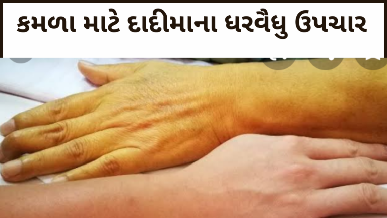 કમળો થાય ત્યારે ખાવ આ ખોરાક તરત અસર ઘટી જશે