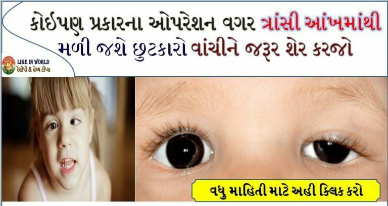 કોઇપણ પ્રકારના ઓપરેશન વગર ત્રાંસી આંખમાંથી મળી જશે છુટકારો વાંચીને જરૂર શેર કરજો