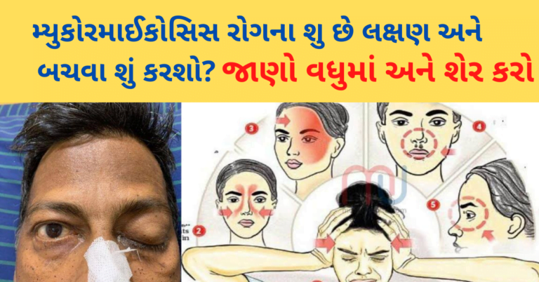 મ્યુકોરમાઈકોસિસ રોગના શુ છે લક્ષણ અને બચવા શું કરશો?