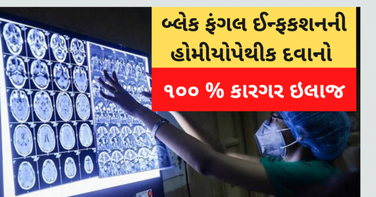 બ્લેક ફંગલ ઈન્ફકશનની હોમીયોપેથીક દવાનો ૧૦૦ % કારગર ઇલાજ
