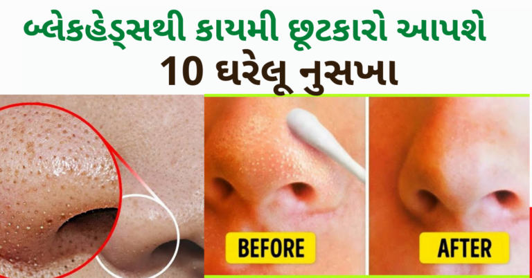 બ્લેકહેડ્સથી કાયમી છૂટકારો આપશે 10 ઘરેલૂ નુસખા