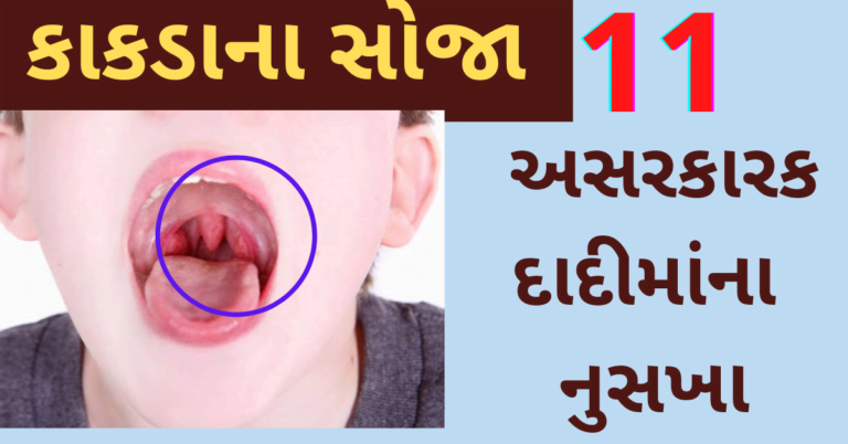 કાકડાના સોજા માટે 11  અસરકારક દાદીમાંના નુસખા