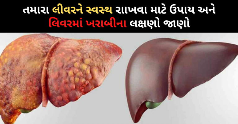 તમારા લીવરને સ્વસ્થ રાખવા માટે ઉપાય અને લિવરમાં ખરાબીના લક્ષણો જાણો