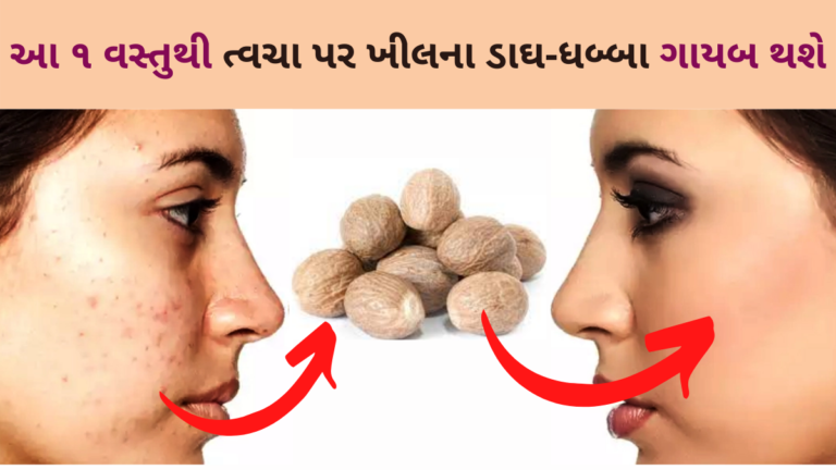 આ ૧ વસ્તુથી ત્વચા પર ખીલના ડાઘ-ધબ્બા ગાયબ થશે