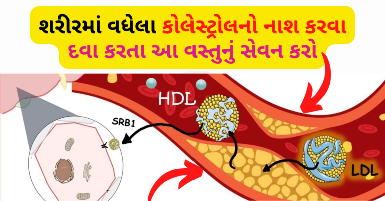 કોલેસ્ટ્રોલ