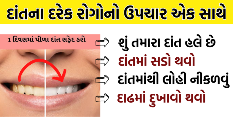 દાંતના દરેક રોગોનો ઉપચાર એક સાથે વાંચજો અને મિત્રો સાથે શેર કરો