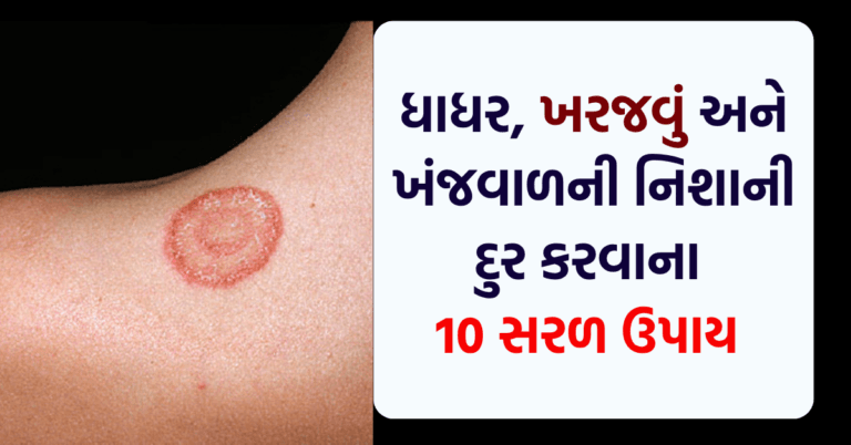 ધાધર, ખરજવું અને ખંજવાળની નિશાની દુર કરવાના 10 સરળ ઉપાય વાંચો અને શેર કરો